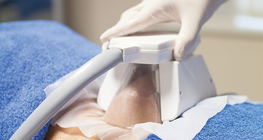 How Fat Freezing and HIFU Work Together? 2 Multiple Areas in One Session HIFU and Fat Freezing Nuneaton