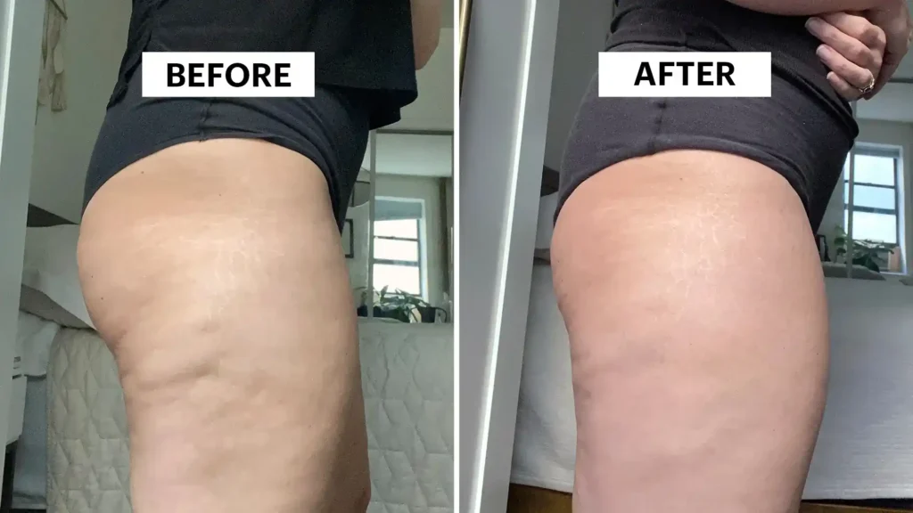 Do Toning Exercise Nuneaton Really Tackle Cellulite?
